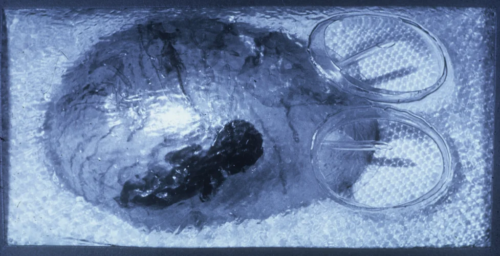 Maternity Egg, 1965-67